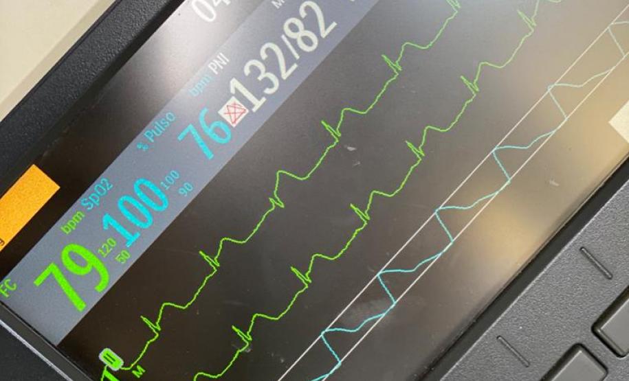 Equipe médica do BPMOA socorre infartado e aplica medicamento trombolítico na RMC